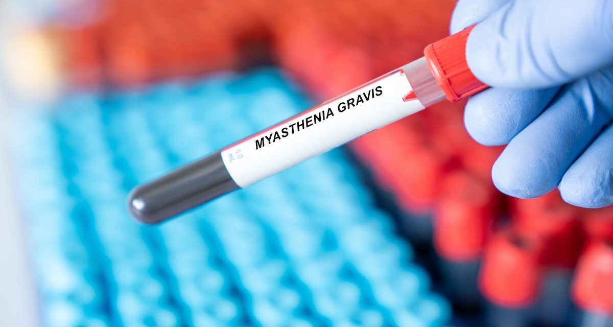 Exacerbations Drive Costs, Utilization in Myasthenia Gravis