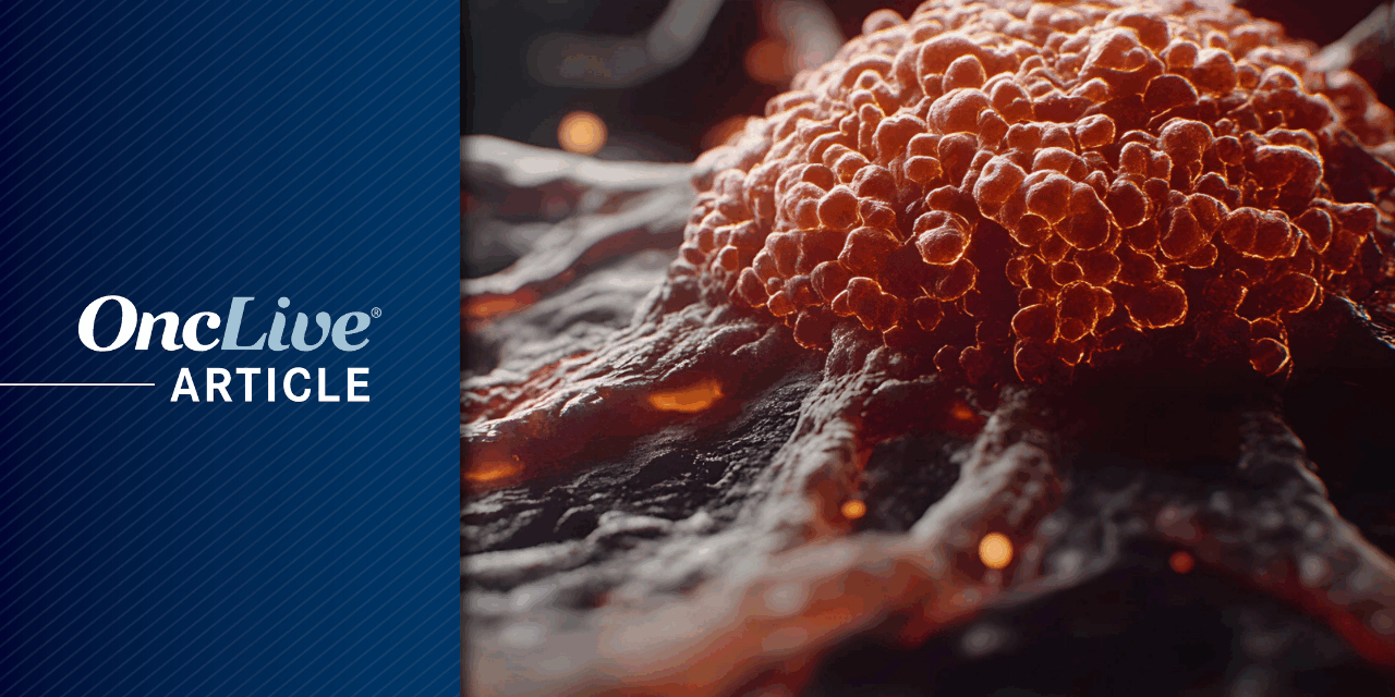 Genomic Test Helps Flag Early Aggressive Prostate Cancer in African American Patients