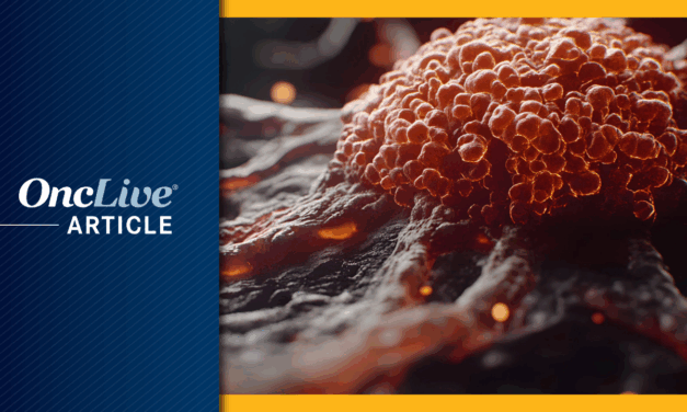 Genomic Test Helps Flag Early Aggressive Prostate Cancer in African American Patients